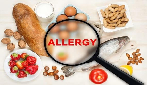 Thumbnail for IGD develops allergen risk assessment template to strengthen food safety